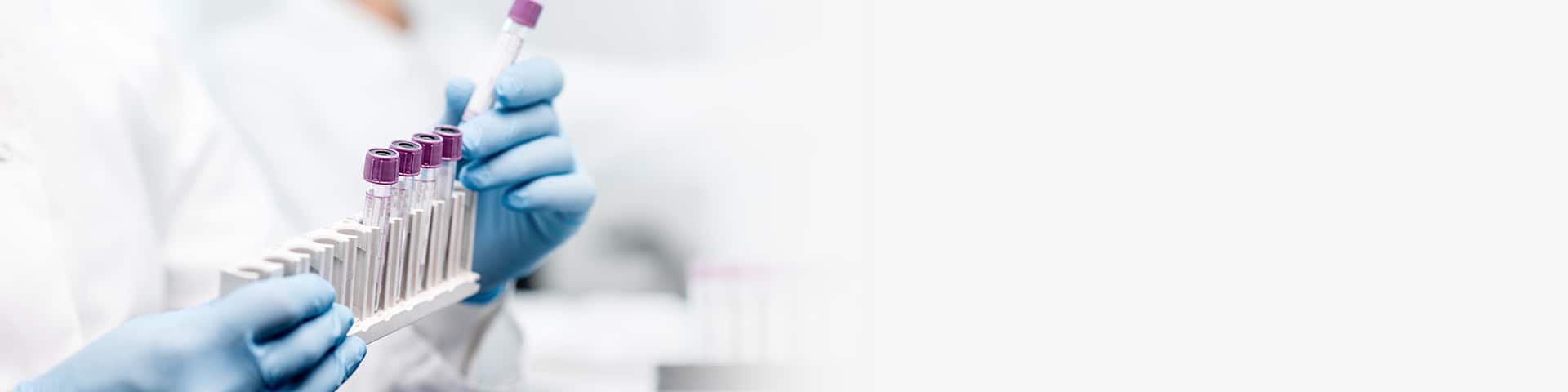 Lab tech handling multiple vials for lab tests