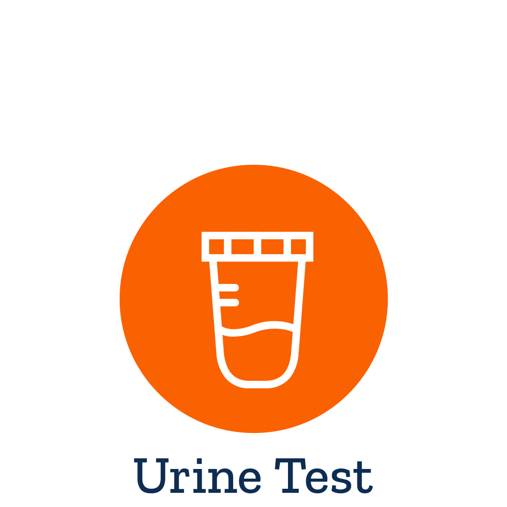 Urinalysis Urine Test - Life Extension